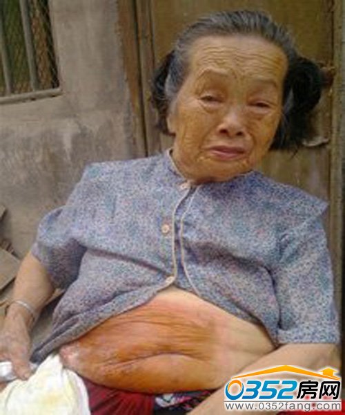 79�q�����Ŷ���һ���֝��� ÿҹ�y����˯ ���O�o�˽o��